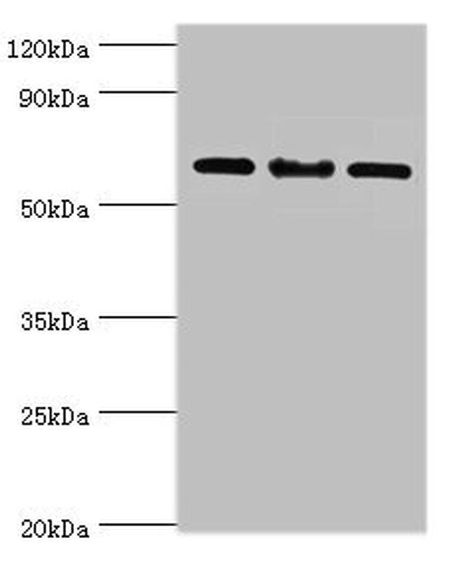 IL-22 Receptor alpha Antibody in Western Blot (WB)