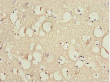 KBTBD7 Antibody in Immunohistochemistry (Paraffin) (IHC (P))