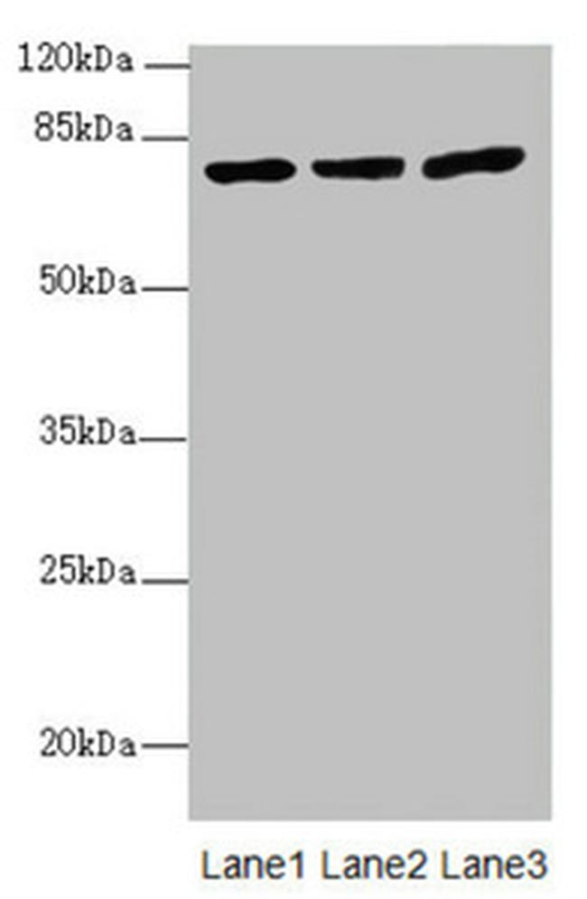 KBTBD7 Antibody in Western Blot (WB)