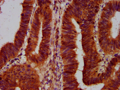 SLC5A5 Antibody in Immunohistochemistry (Paraffin) (IHC (P))