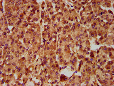 SLC5A5 Antibody in Immunohistochemistry (Paraffin) (IHC (P))