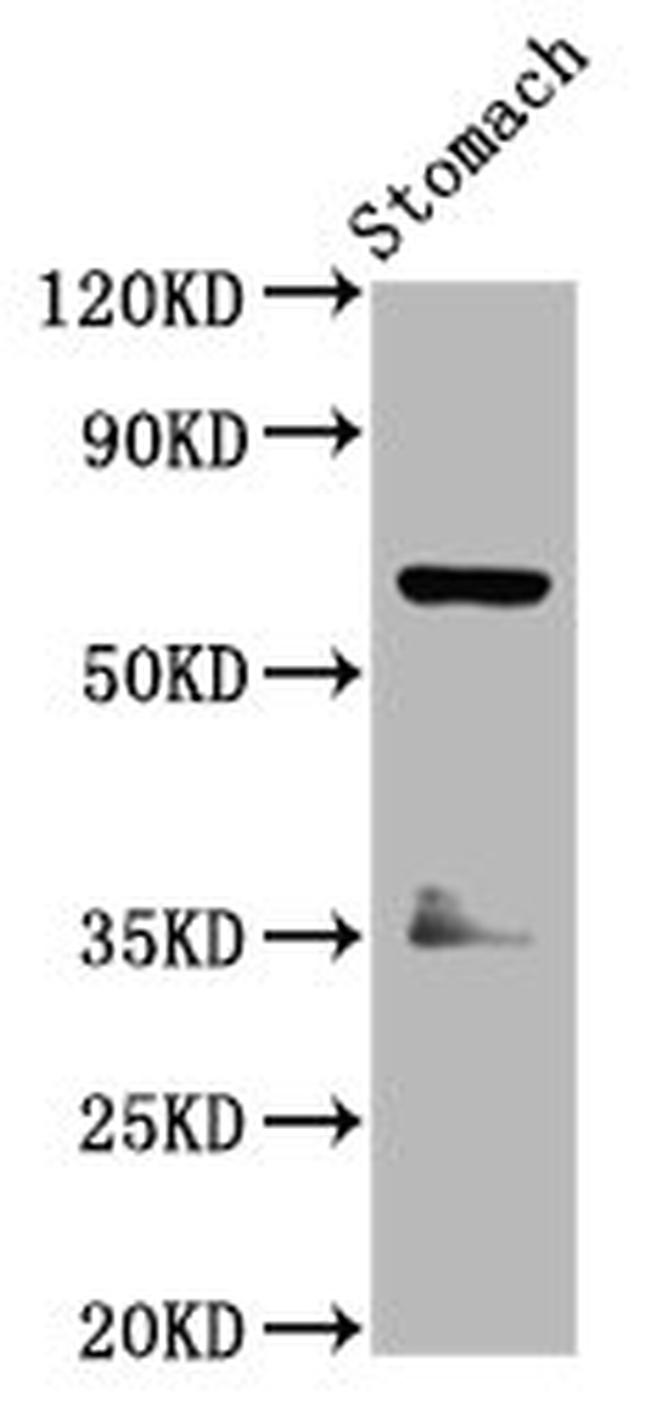 SLC5A5 Antibody in Western Blot (WB)