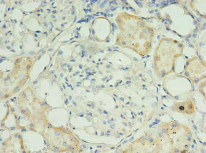 RPUSD4 Antibody in Immunohistochemistry (Paraffin) (IHC (P))