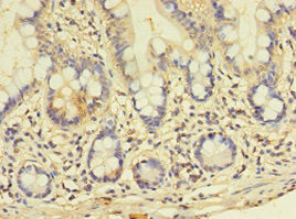 GALNT14 Antibody in Immunohistochemistry (Paraffin) (IHC (P))