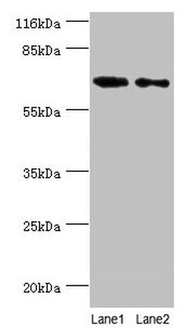 GALNT14 Antibody in Western Blot (WB)