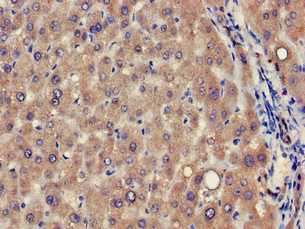 VPS39 Antibody in Immunohistochemistry (Paraffin) (IHC (P))