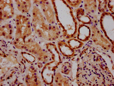 ACRC Antibody in Immunohistochemistry (Paraffin) (IHC (P))