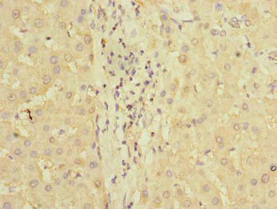 PDCL2 Antibody in Immunohistochemistry (Paraffin) (IHC (P))