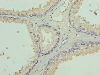 L3MBTL4 Antibody in Immunohistochemistry (Paraffin) (IHC (P))