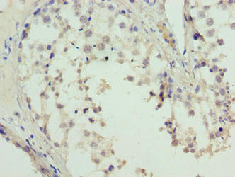 L3MBTL4 Antibody in Immunohistochemistry (Paraffin) (IHC (P))