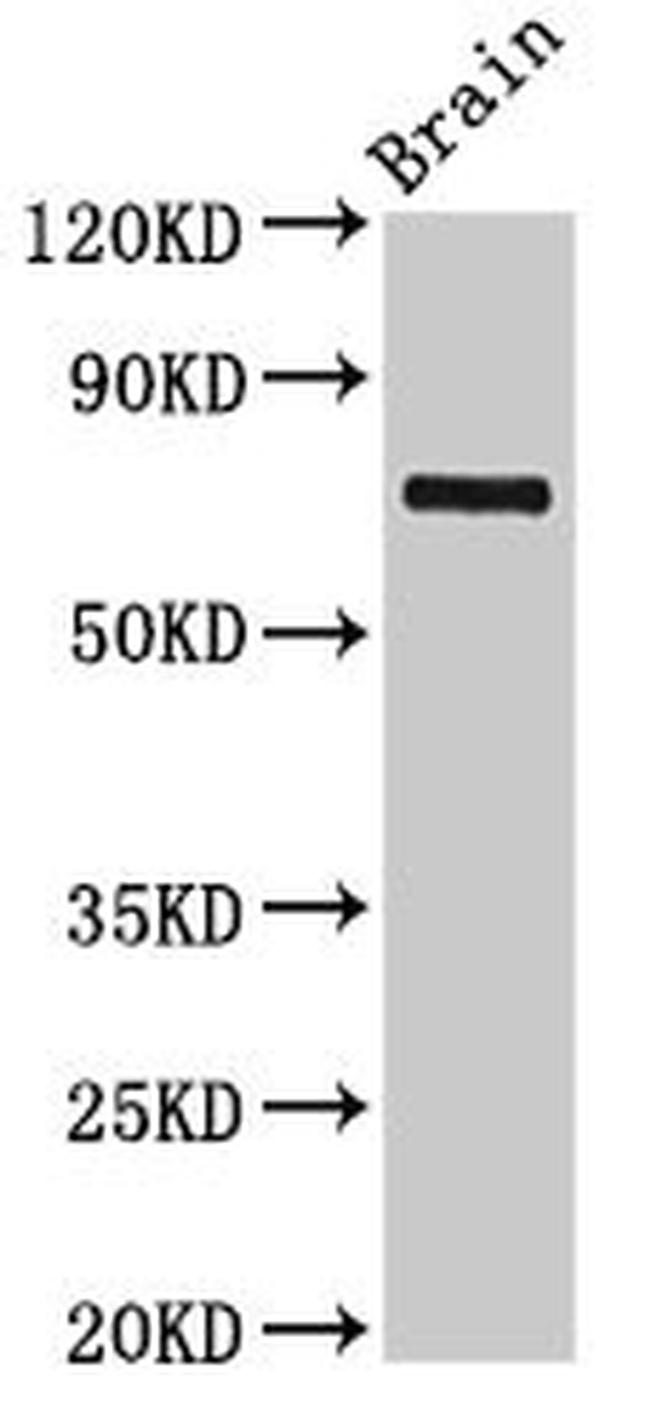 L3MBTL4 Antibody in Western Blot (WB)