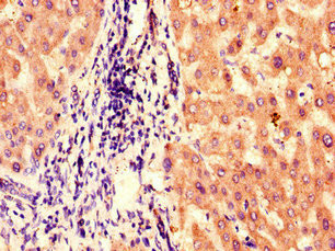 BBS1 Antibody in Immunohistochemistry (Paraffin) (IHC (P))