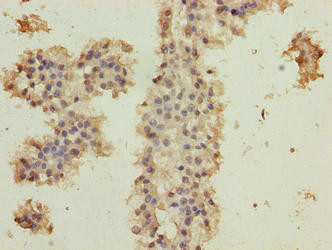 C10orf82 Antibody in Immunohistochemistry (Paraffin) (IHC (P))