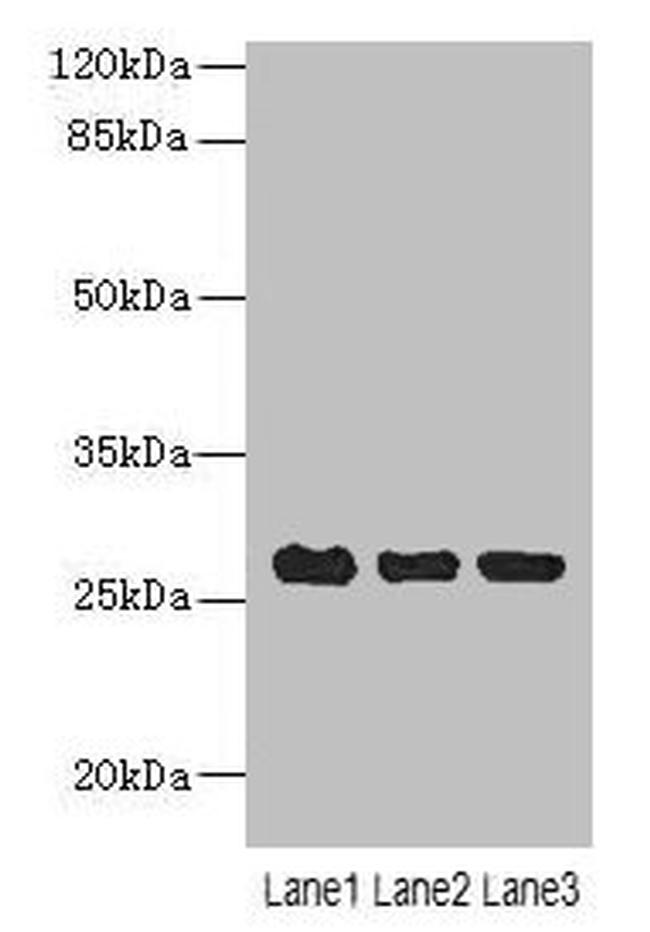 C10orf82 Antibody in Western Blot (WB)