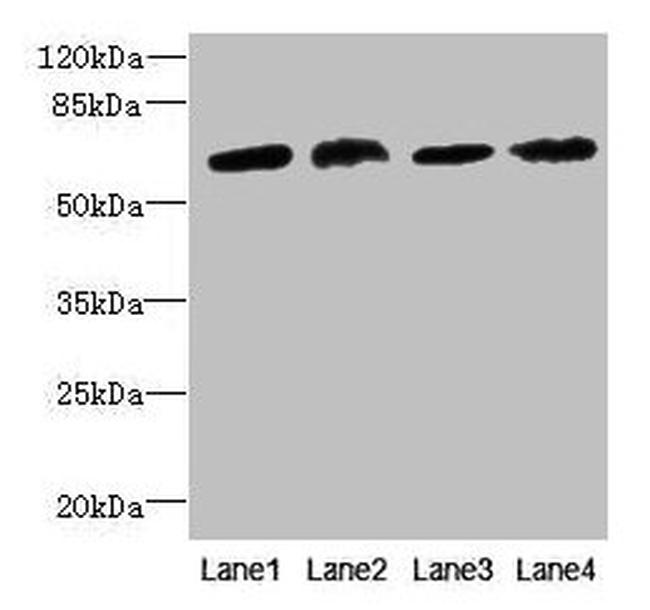 CEP63 Antibody in Western Blot (WB)