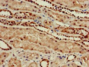 C22orf13 Antibody in Immunohistochemistry (Paraffin) (IHC (P))