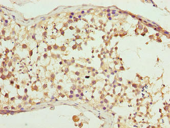 WDR16 Antibody in Immunohistochemistry (Paraffin) (IHC (P))