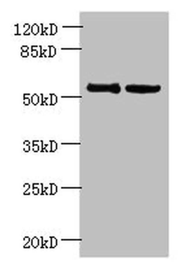 UTP15 Antibody in Western Blot (WB)
