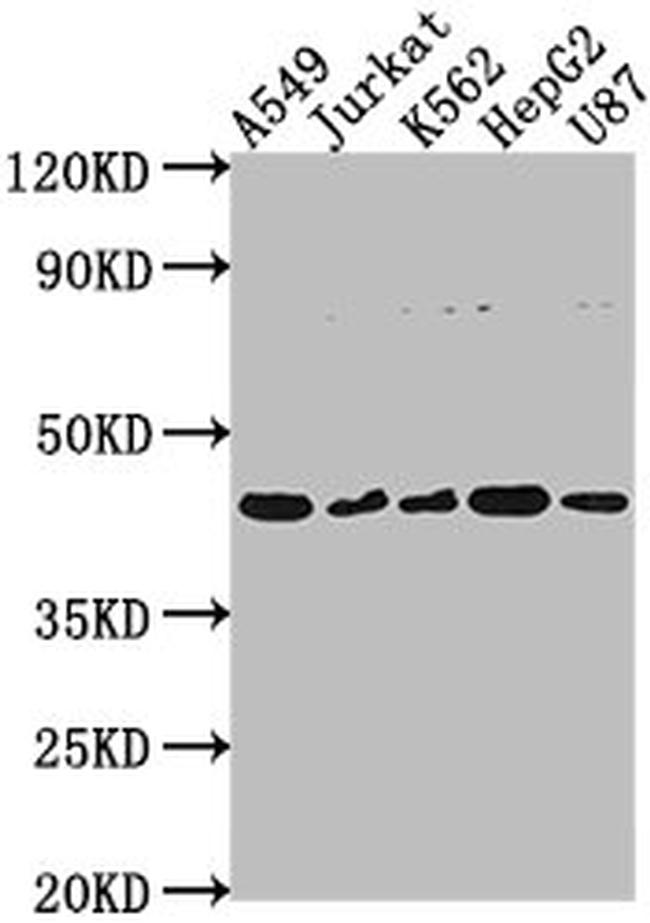 DNASE2B Antibody in Western Blot (WB)