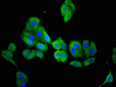 ACY3 Antibody in Immunocytochemistry (ICC/IF)