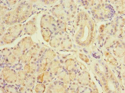 TBC1D19 Antibody in Immunohistochemistry (Paraffin) (IHC (P))