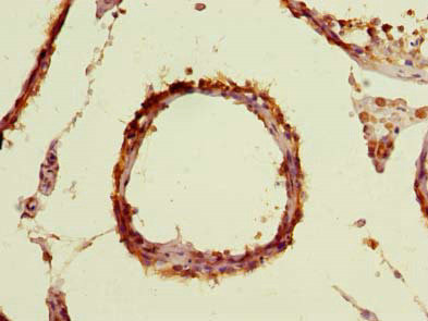 TBC1D19 Antibody in Immunohistochemistry (Paraffin) (IHC (P))