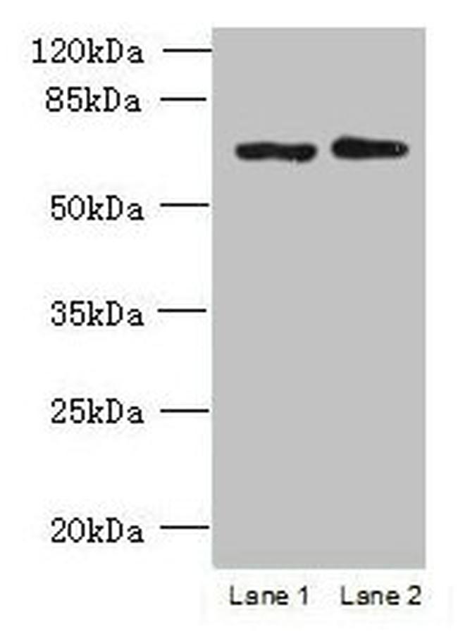 TBC1D19 Antibody in Western Blot (WB)