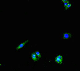 PNPLA1 Antibody in Immunocytochemistry (ICC/IF)