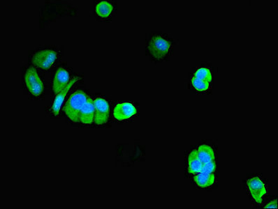 PNPLA1 Antibody in Immunocytochemistry (ICC/IF)