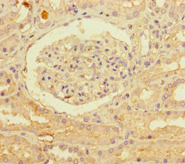 PNPLA1 Antibody in Immunohistochemistry (Paraffin) (IHC (P))