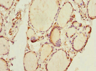 THRSP Antibody in Immunohistochemistry (Paraffin) (IHC (P))