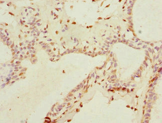 THRSP Antibody in Immunohistochemistry (Paraffin) (IHC (P))