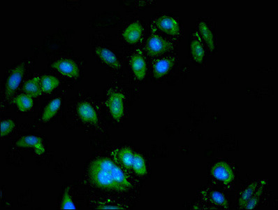 ATP6V0A1 Antibody in Immunocytochemistry (ICC/IF)