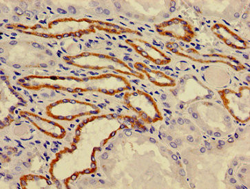 ATP6V0A1 Antibody in Immunohistochemistry (Paraffin) (IHC (P))