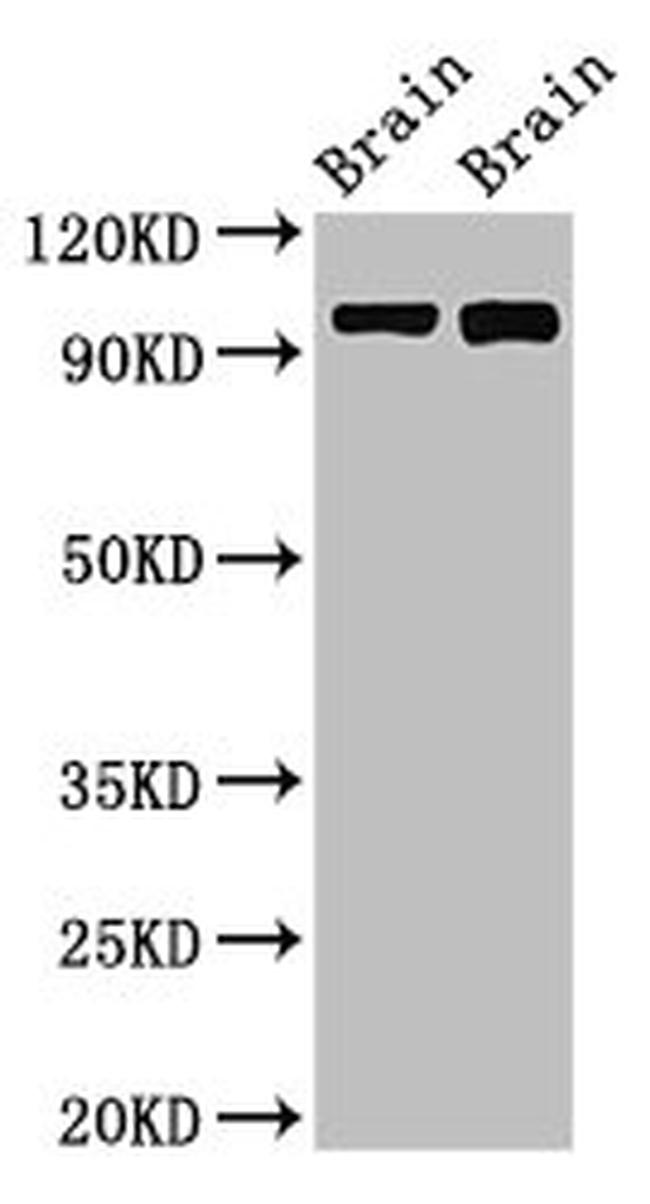 ATP6V0A1 Antibody in Western Blot (WB)