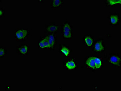 TBC1D20 Antibody in Immunocytochemistry (ICC/IF)