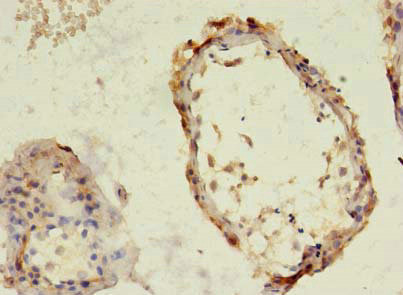 TBC1D20 Antibody in Immunohistochemistry (Paraffin) (IHC (P))