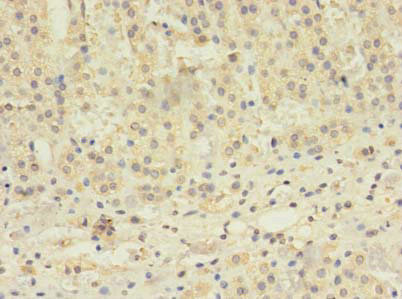 TBC1D20 Antibody in Immunohistochemistry (Paraffin) (IHC (P))