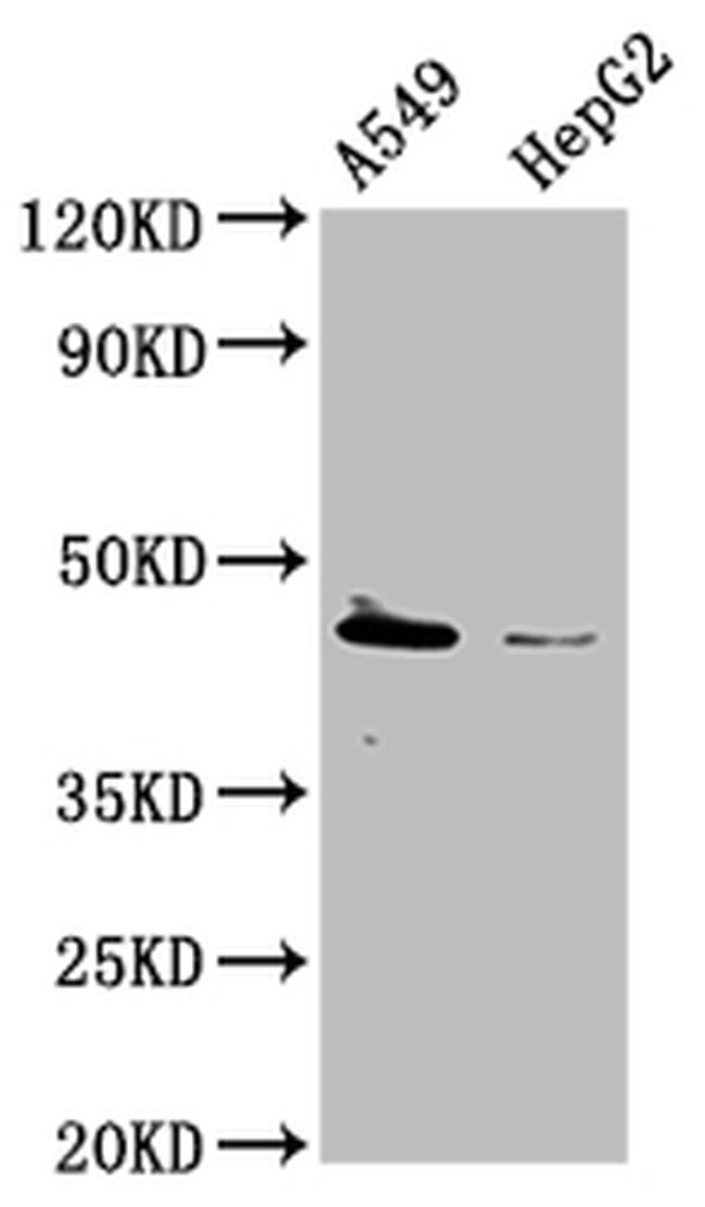 TBC1D20 Antibody in Western Blot (WB)