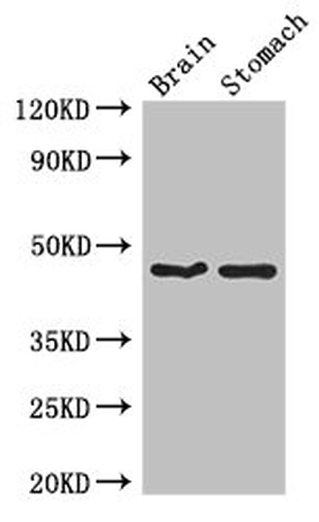 TBC1D20 Antibody in Western Blot (WB)