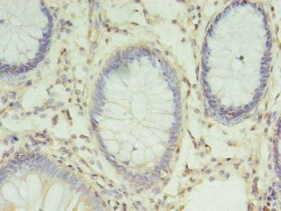 CHMP6 Antibody in Immunohistochemistry (Paraffin) (IHC (P))