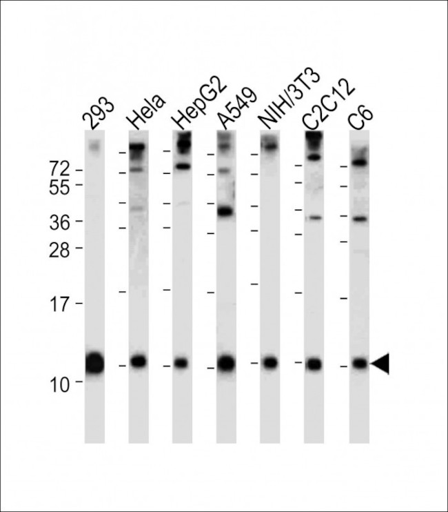 Ubiquitin Antibody in Western Blot (WB)