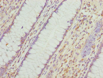 VWA9 Antibody in Immunohistochemistry (Paraffin) (IHC (P))