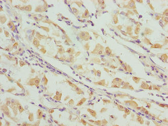 VWA9 Antibody in Immunohistochemistry (Paraffin) (IHC (P))