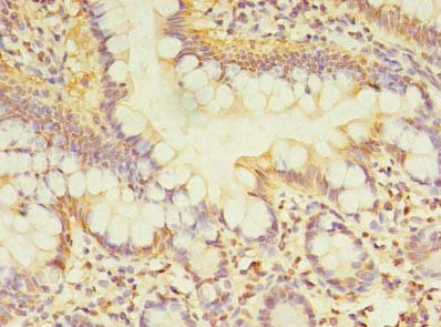 TCP11L2 Antibody in Immunohistochemistry (Paraffin) (IHC (P))