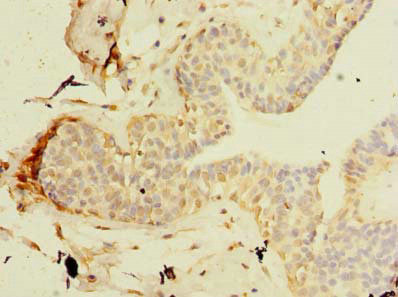 TCP11L2 Antibody in Immunohistochemistry (Paraffin) (IHC (P))