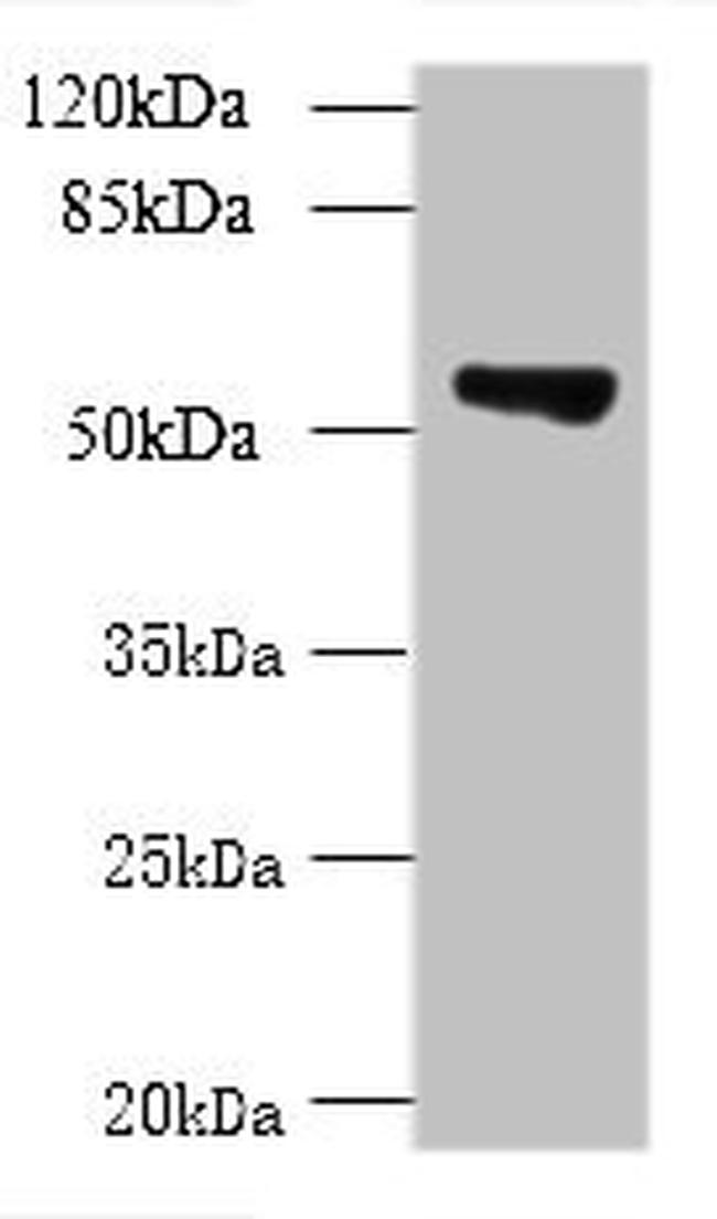 TCP11L2 Antibody in Western Blot (WB)