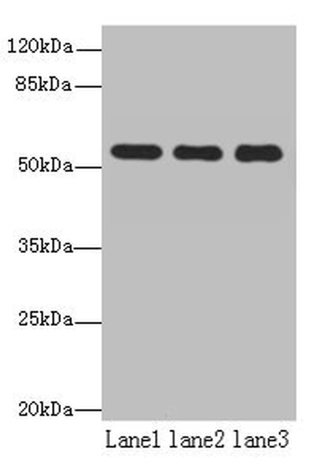 TBC1D22A Antibody in Western Blot (WB)