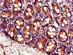 YLAT2 Antibody in Immunohistochemistry (Paraffin) (IHC (P))