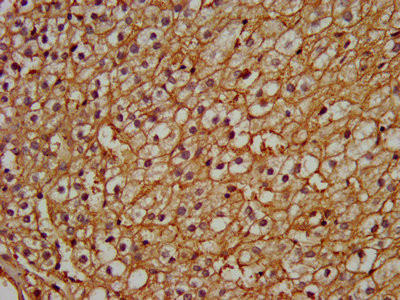 PEX13 Antibody in Immunohistochemistry (Paraffin) (IHC (P))